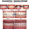 Invisible Braces Orthodontic Braces