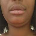 Coco Lip Plumper